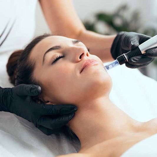 Microneedling